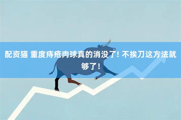 配资猫 重度痔疮肉球真的消没了! 不挨刀这方法就够了！